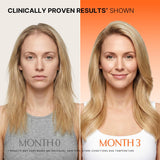 BARUBT Grow:Care Hair Scalp Ampoule | Healthy Hair Growth | Organic Wellness Hub