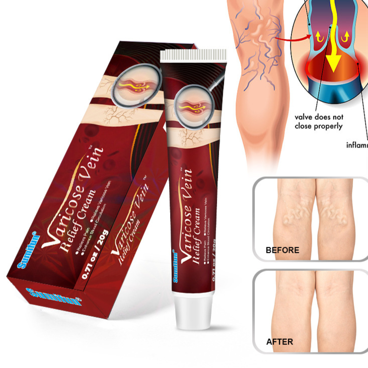 Varicose Veins Relief Cream 2-Pack - Soothing Balm | Organic Wellness Hub