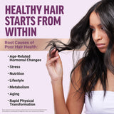 Force Factor Hair Growth Accelerator 3-Pack | 180 Soft Chews with LUSTRIVA® | Mixed Berry | 90-Day Supply | Thicker, Fuller Hair Starting in 3 Weeks | Non-GMO | No Artificial Sweeteners